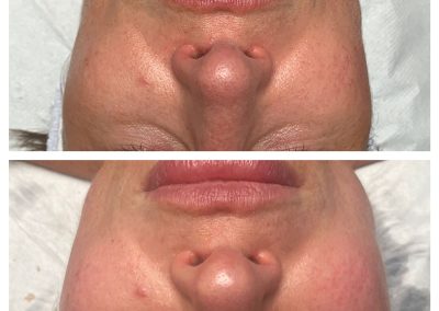Elaine Brennan Peel Results Eleni London